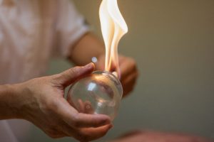 fire cupping photo