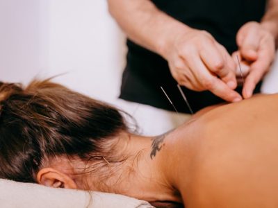 Acupuncture treatment