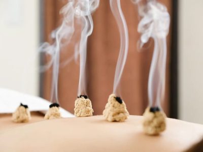 Moxibustion in use