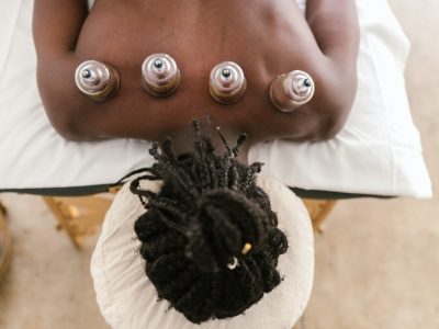 person receiving cupping treatment